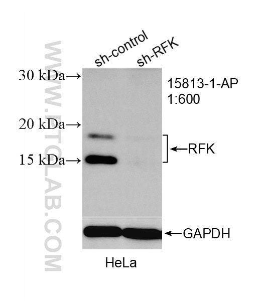 Western Blot (WB) analysis of HeLa cells using RFK Polyclonal antibody (15813-1-AP)