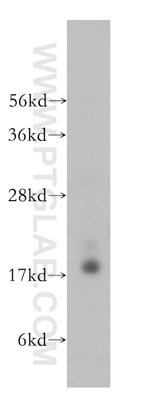 Western Blot (WB) analysis of HeLa cells using RFK Polyclonal antibody (15813-1-AP)