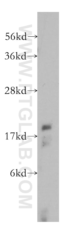 Western Blot (WB) analysis of Jurkat cells using RFK Polyclonal antibody (15813-1-AP)