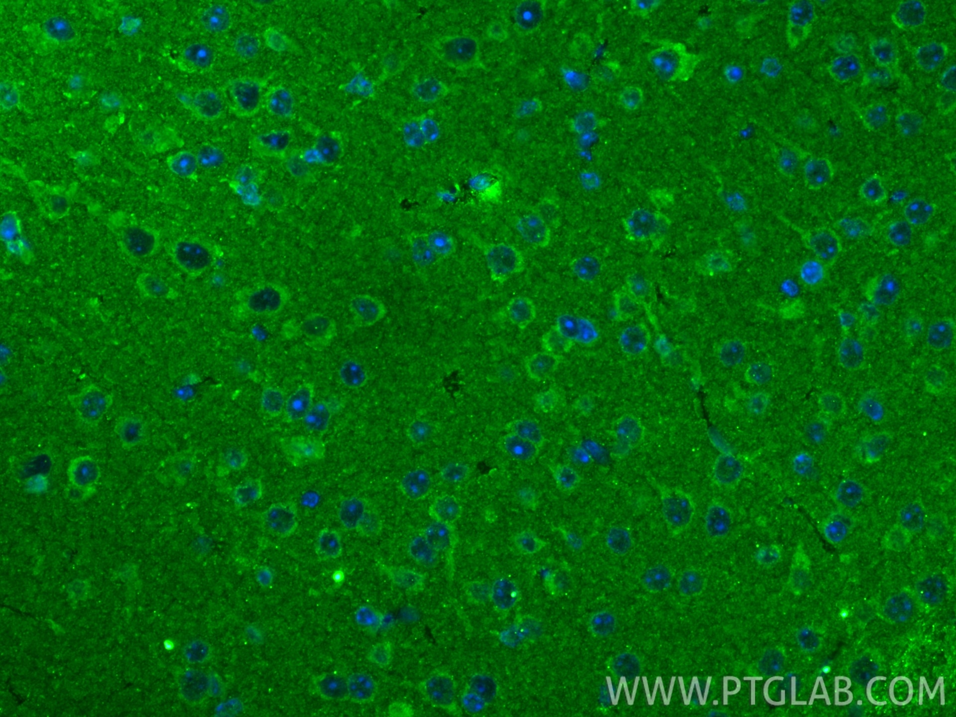 Immunofluorescence (IF) / fluorescent staining of mouse brain tissue using RFK Recombinant monoclonal antibody (85032-2-RR)