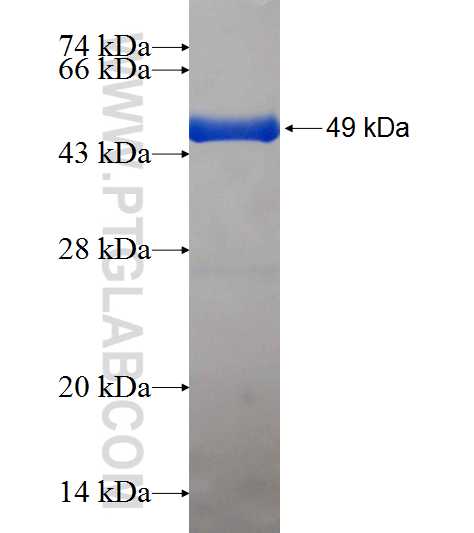 RFK fusion protein Ag8591 SDS-PAGE