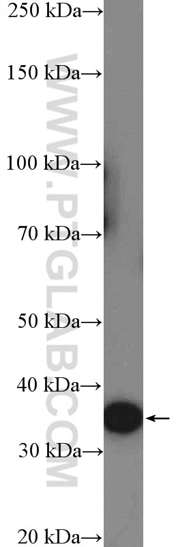 Western Blot (WB) analysis of HeLa cells using RFPL1/2/3 Polyclonal antibody (13215-1-AP)