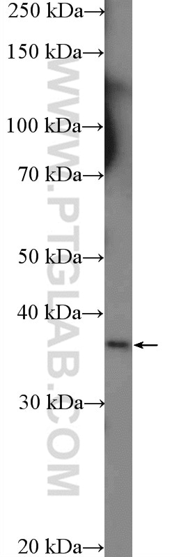 Western Blot (WB) analysis of SKOV-3 cells using RFPL1/2/3 Polyclonal antibody (13215-1-AP)