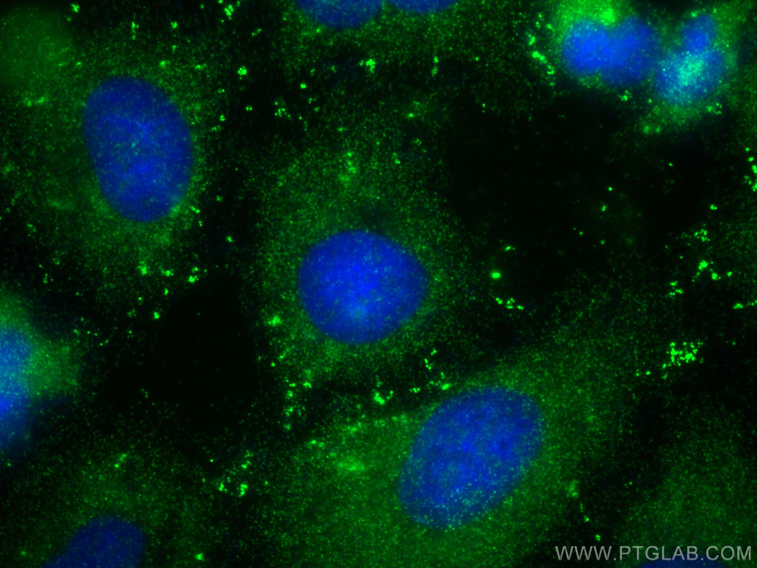 Immunofluorescence (IF) / fluorescent staining of A549 cells using RFPL4B-Specific Polyclonal antibody (20207-1-AP)