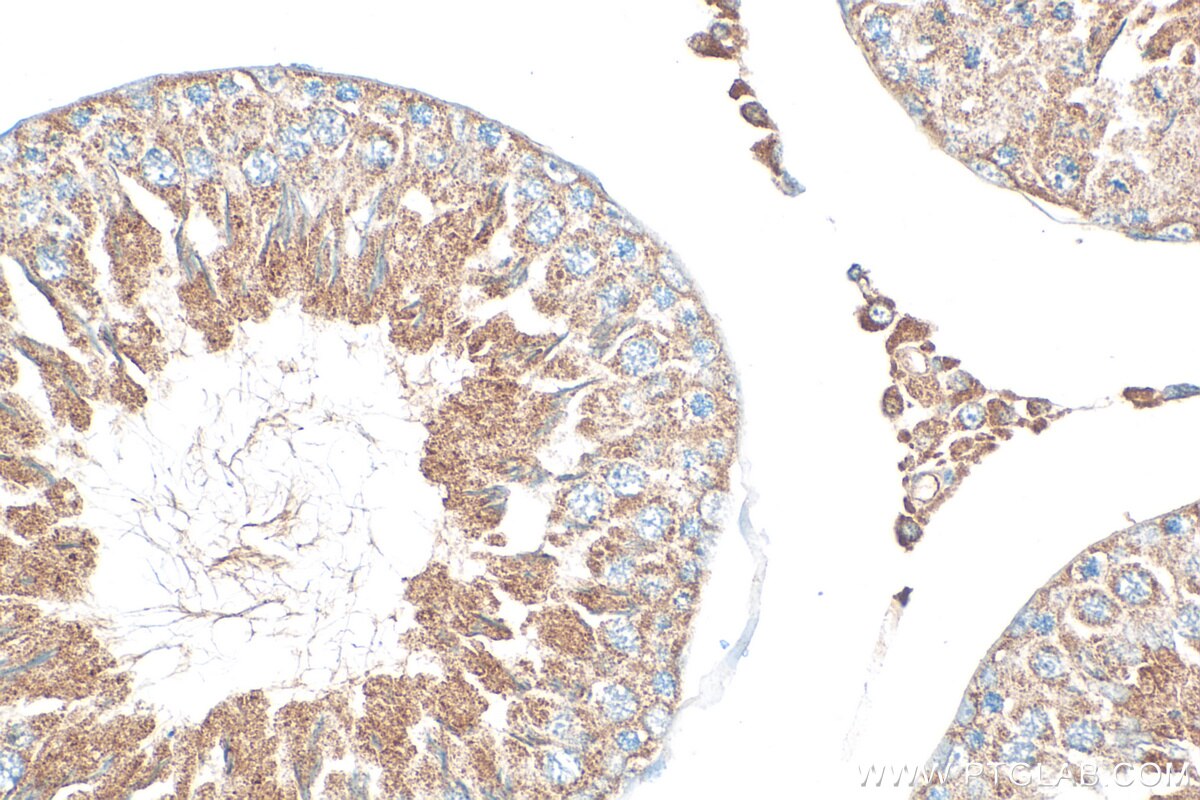 Immunohistochemistry (IHC) staining of rat testis tissue using RFPL4B-Specific Polyclonal antibody (20207-1-AP)