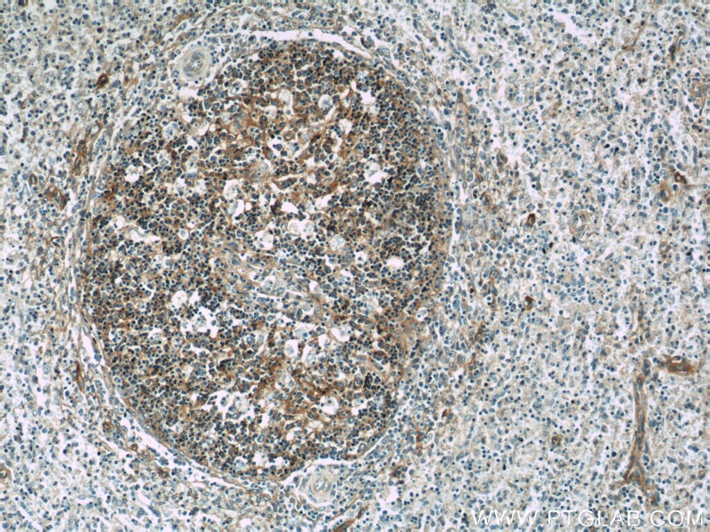 Immunohistochemistry (IHC) staining of human spleen tissue using RFTN1 Polyclonal antibody (24289-1-AP)