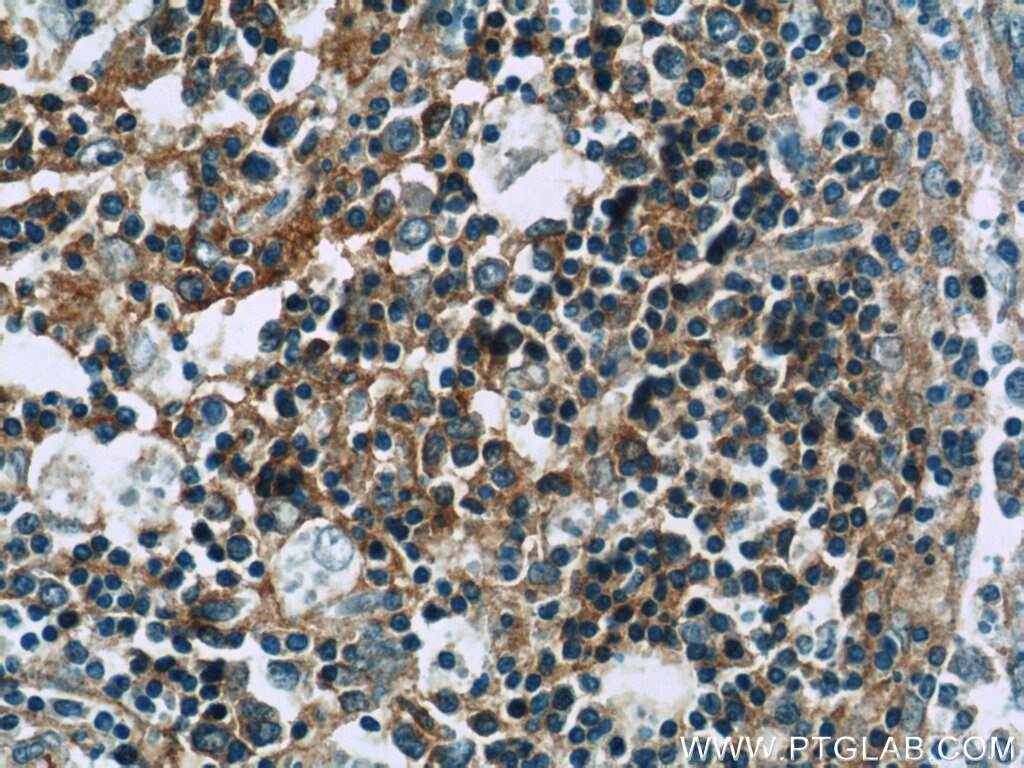 IHC staining of human spleen using 24289-1-AP