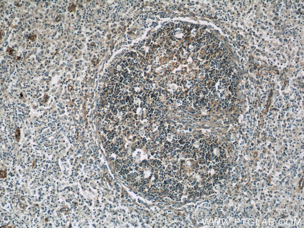 IHC staining of human spleen using 24289-1-AP