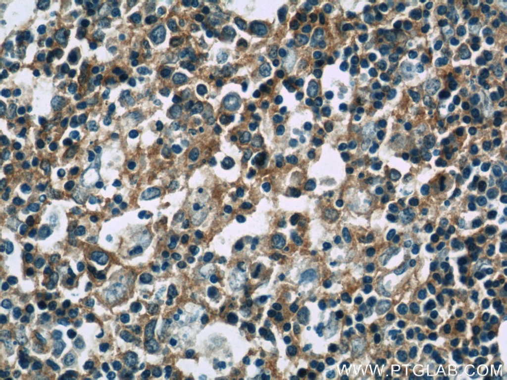 Immunohistochemistry (IHC) staining of human spleen tissue using RFTN1 Polyclonal antibody (24289-1-AP)