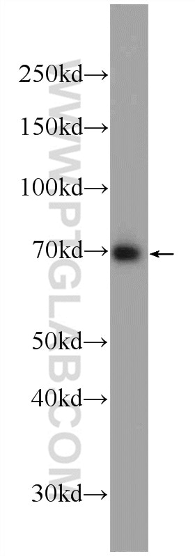 Western Blot (WB) analysis of HeLa cells using RFTN1 Polyclonal antibody (24289-1-AP)