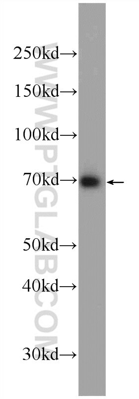 Western Blot (WB) analysis of HeLa cells using RFTN1 Polyclonal antibody (24289-1-AP)