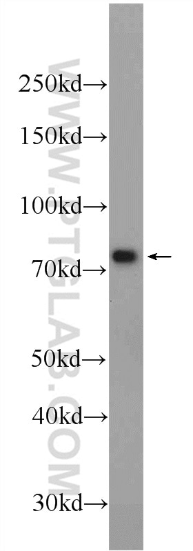 Western Blot (WB) analysis of Raji cells using RFTN1 Polyclonal antibody (24289-1-AP)