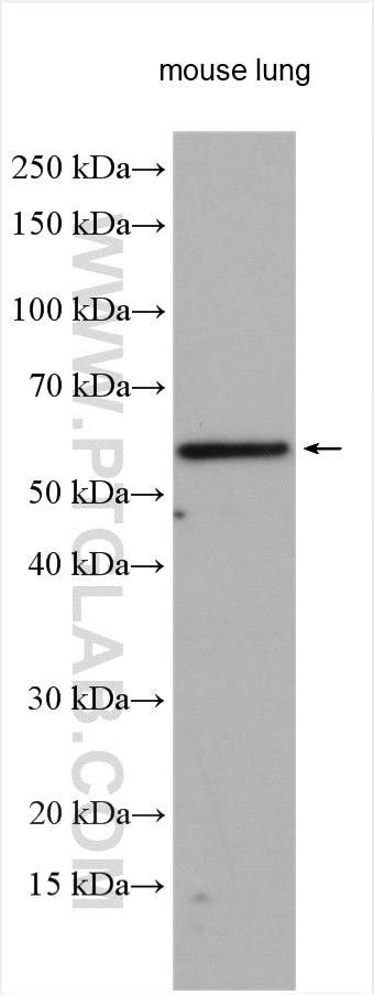 Western Blot (WB) analysis of various lysates using RFTN2 Polyclonal antibody (17854-1-AP)