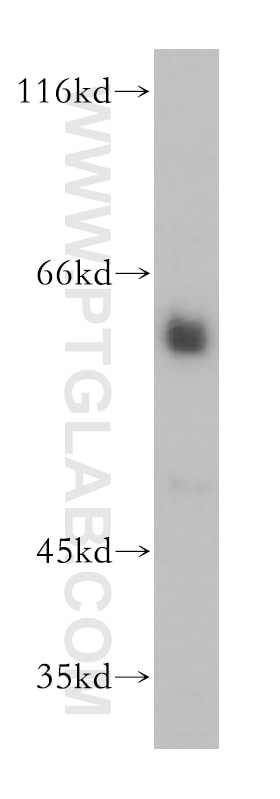 Western Blot (WB) analysis of mouse brain tissue using RFTN2 Polyclonal antibody (17854-1-AP)