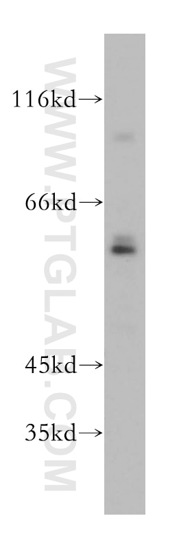 Western Blot (WB) analysis of mouse testis tissue using RFTN2 Polyclonal antibody (17854-1-AP)