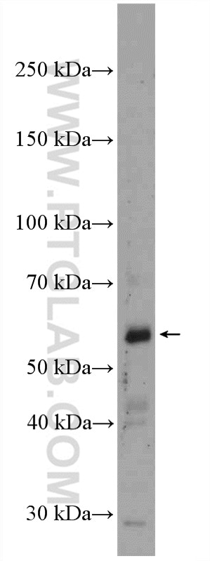 Western Blot (WB) analysis of mouse heart tissue using COP1 Polyclonal antibody (13542-1-AP)