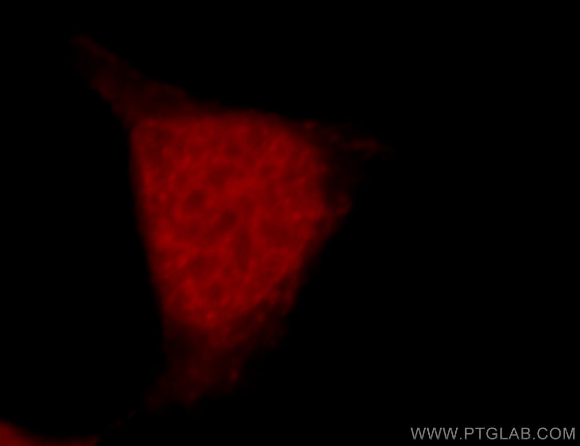 Immunofluorescence (IF) / fluorescent staining of HEK-293 cells using RFWD3 Polyclonal antibody (19893-1-AP)