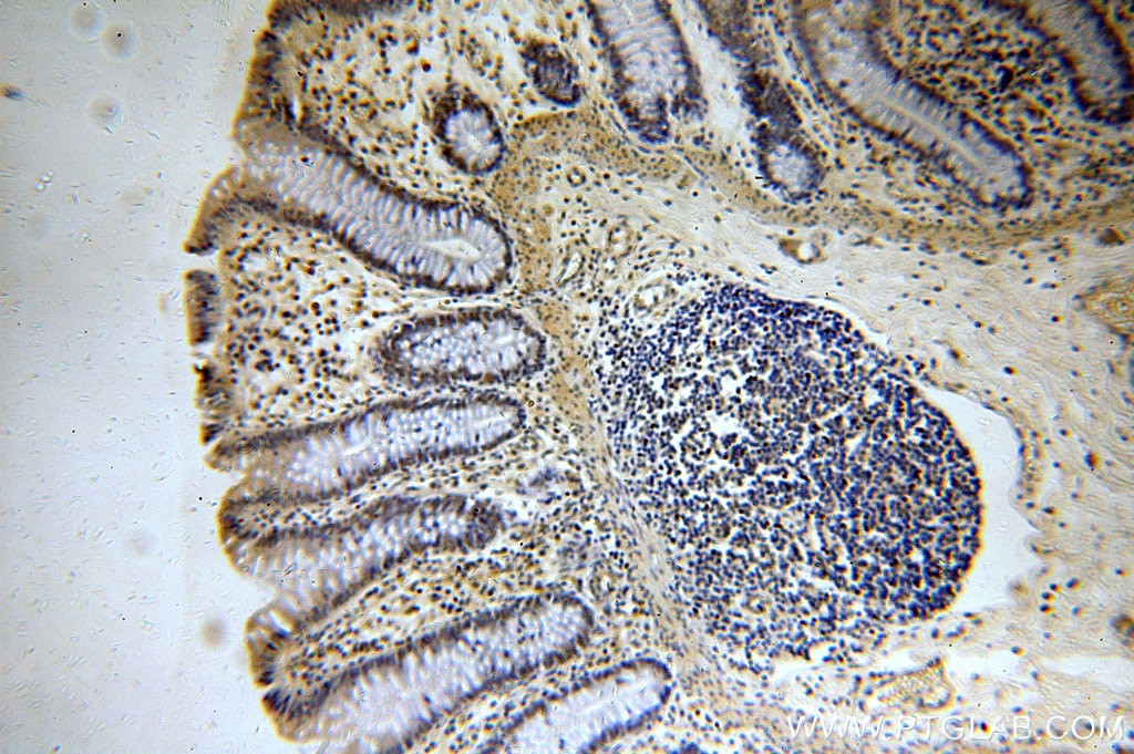 IHC staining of human colon using 19893-1-AP