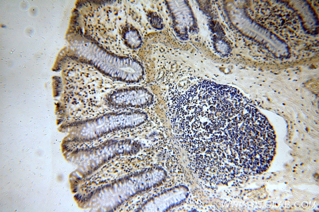 Immunohistochemistry (IHC) staining of human colon tissue using RFWD3 Polyclonal antibody (19893-1-AP)