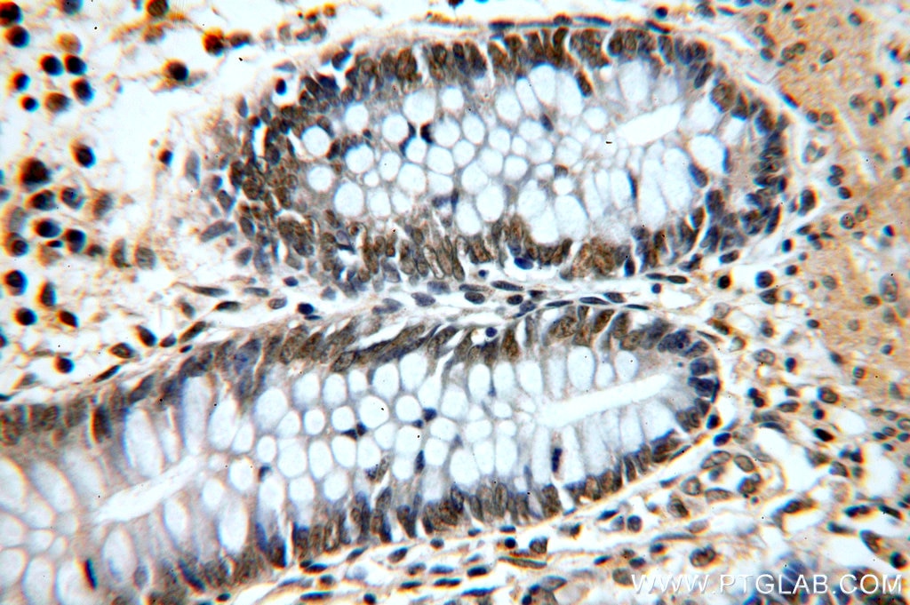 Immunohistochemistry (IHC) staining of human colon tissue using RFWD3 Polyclonal antibody (19893-1-AP)