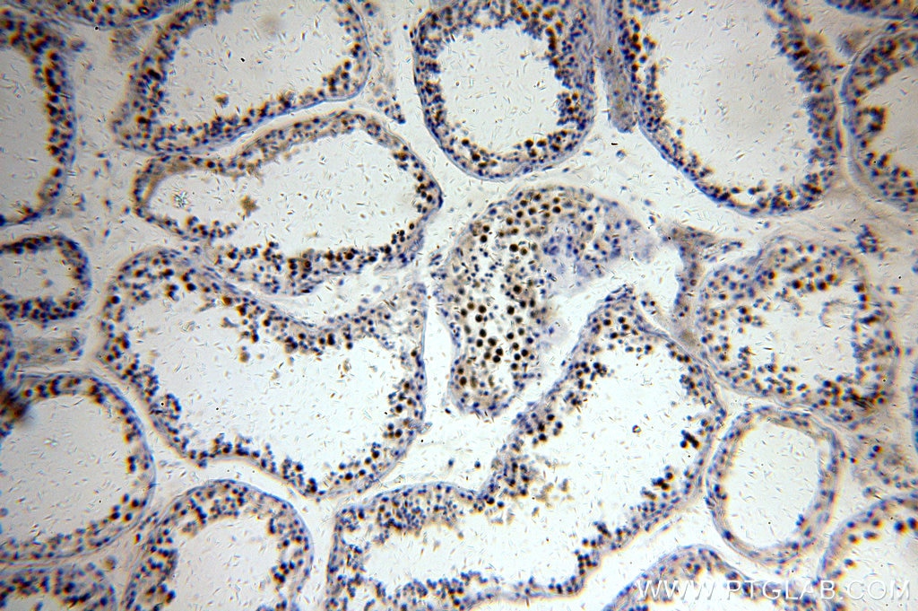 Immunohistochemistry (IHC) staining of human testis tissue using RFWD3 Polyclonal antibody (19893-1-AP)