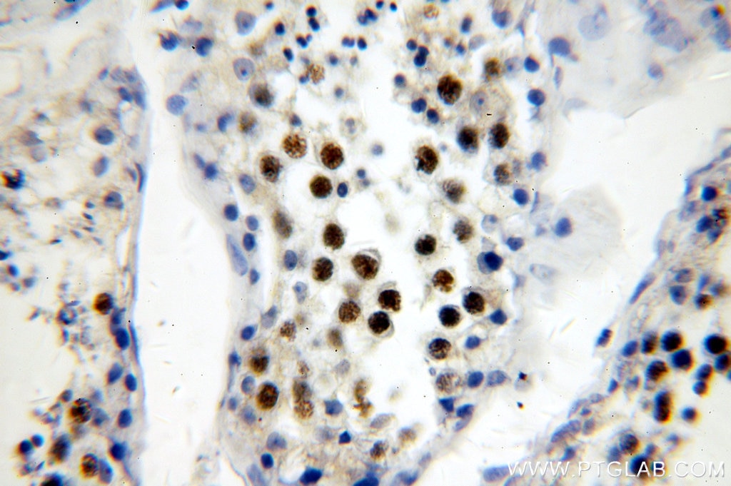 Immunohistochemistry (IHC) staining of human testis tissue using RFWD3 Polyclonal antibody (19893-1-AP)
