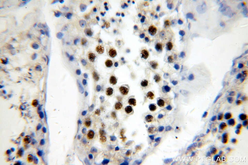 Immunohistochemistry (IHC) staining of human testis tissue using RFWD3 Polyclonal antibody (19893-1-AP)