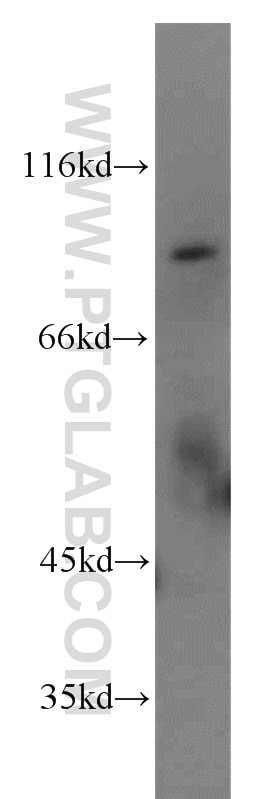 Western Blot (WB) analysis of mouse lung tissue using RFWD3 Polyclonal antibody (19893-1-AP)