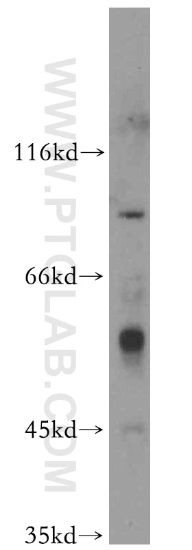 Western Blot (WB) analysis of mouse lung tissue using RFWD3 Polyclonal antibody (19893-1-AP)