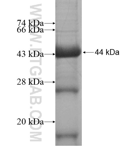 RFWD3 fusion protein Ag13769 SDS-PAGE