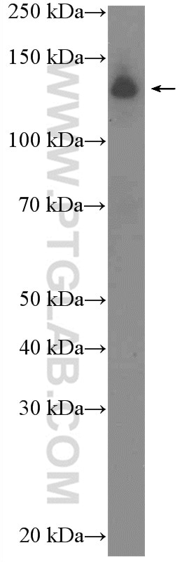 Western Blot (WB) analysis of HL-60 cells using RFX1 Polyclonal antibody (26859-1-AP)