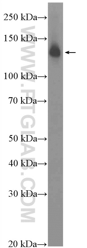 Western Blot (WB) analysis of Jurkat cells using RFX1 Polyclonal antibody (26859-1-AP)