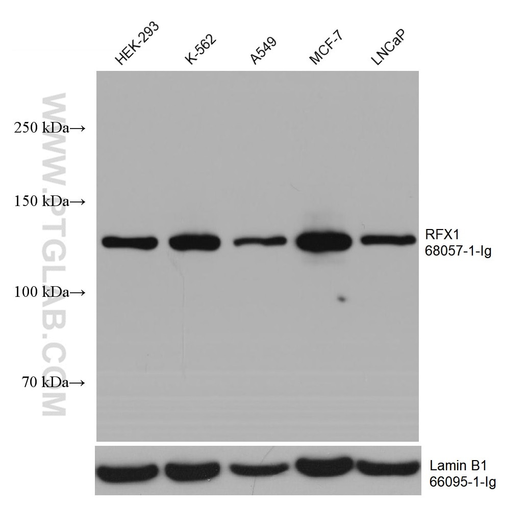 WB analysis using 68057-1-Ig