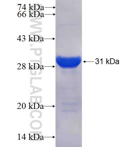 RFX1 fusion protein Ag25442 SDS-PAGE