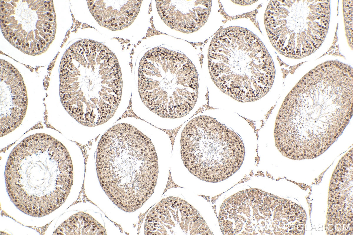 Immunohistochemistry (IHC) staining of rat testis tissue using RFX2 Polyclonal antibody (12622-1-AP)