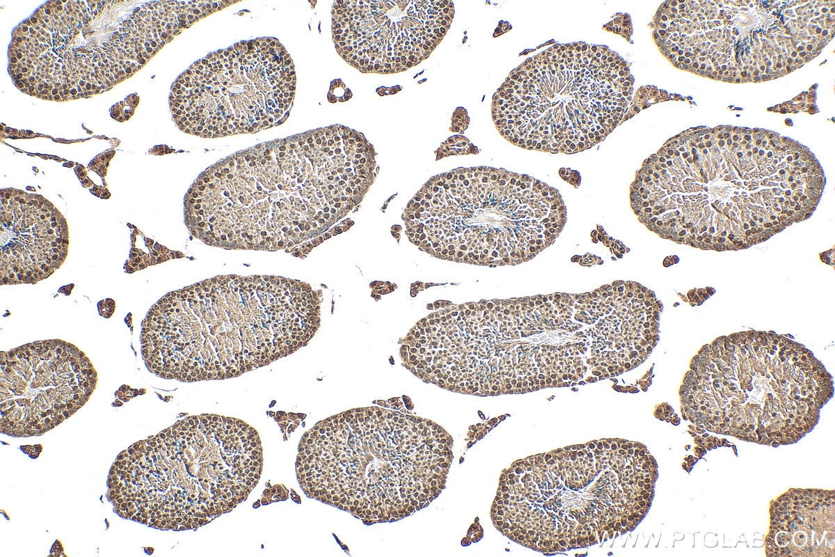 Immunohistochemistry (IHC) staining of mouse testis tissue using RFX2 Polyclonal antibody (12622-1-AP)