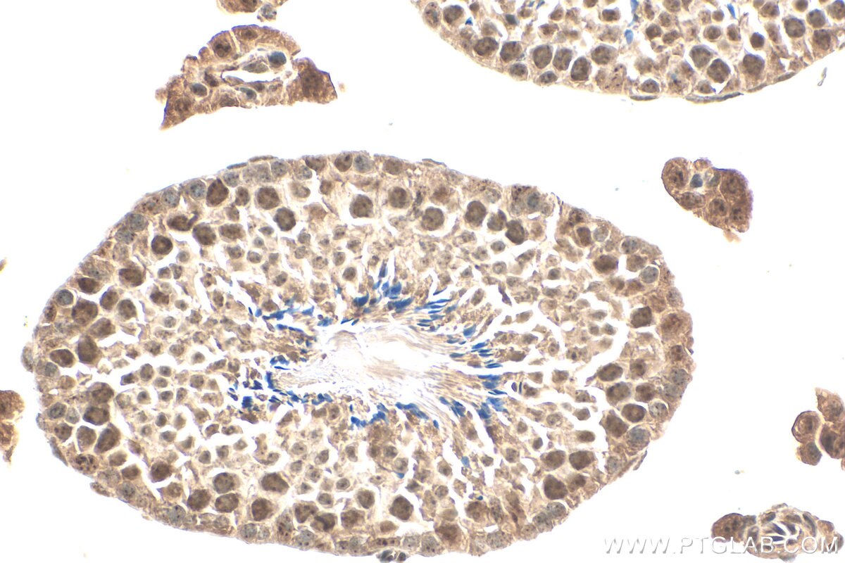 Immunohistochemistry (IHC) staining of mouse testis tissue using RFX2 Polyclonal antibody (12622-1-AP)