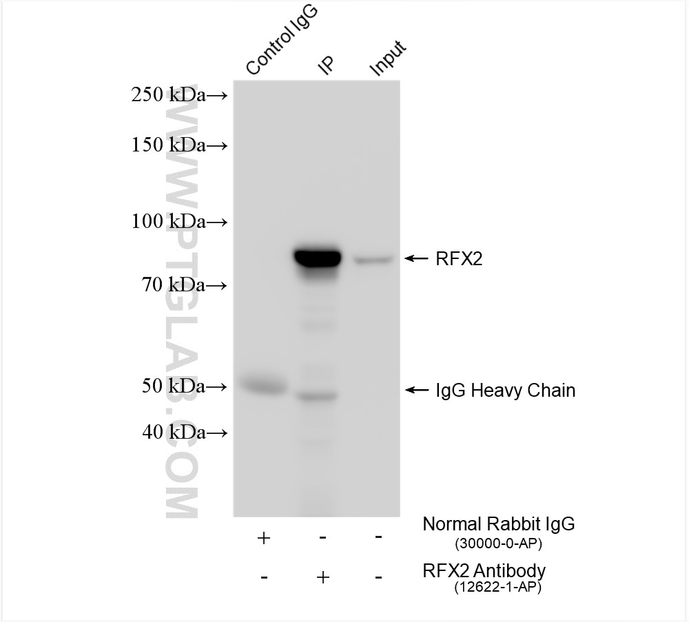 Immunoprecipitation (IP) experiment of THP-1 cells using RFX2 Polyclonal antibody (12622-1-AP)