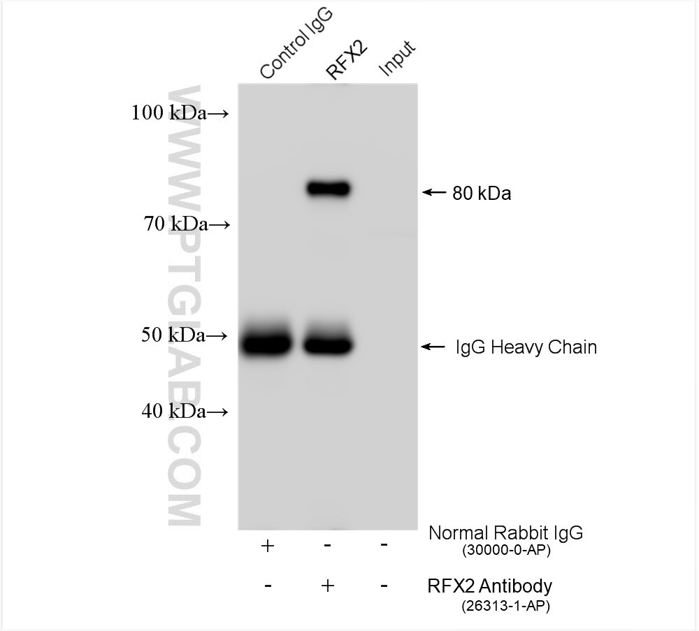 Immunoprecipitation (IP) experiment of mouse testis tissue using RFX2 Polyclonal antibody (26313-1-AP)