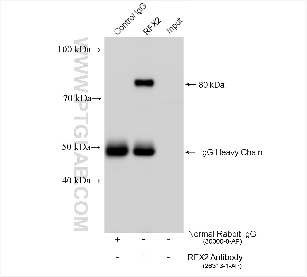 Immunoprecipitation (IP) experiment of mouse testis tissue using RFX2 Polyclonal antibody (26313-1-AP)