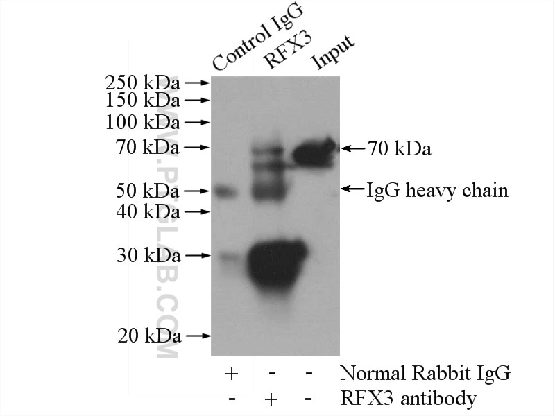 Immunoprecipitation (IP) experiment of HeLa cells using RFX3 Polyclonal antibody (14784-1-AP)