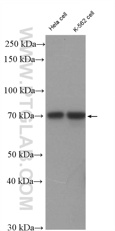 Western Blot (WB) analysis of HeLa cells using RFX3 Polyclonal antibody (14784-1-AP)