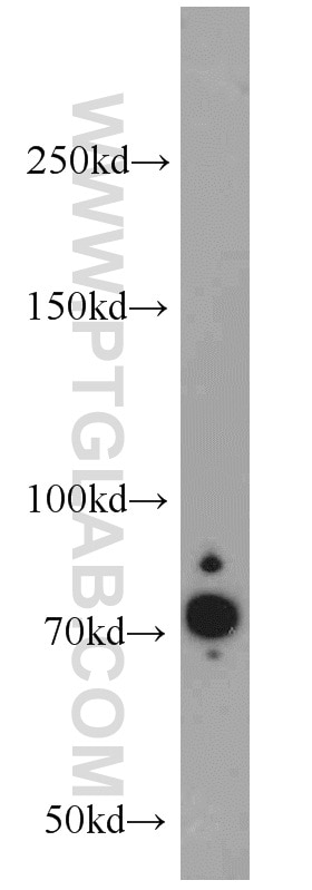 Western Blot (WB) analysis of HeLa cells using RFX3 Polyclonal antibody (14784-1-AP)
