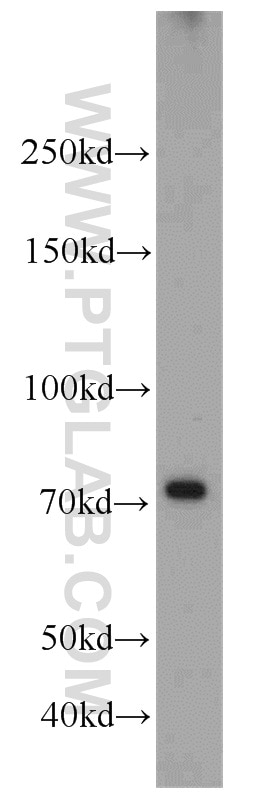 Western Blot (WB) analysis of K-562 cells using RFX3 Polyclonal antibody (14784-1-AP)
