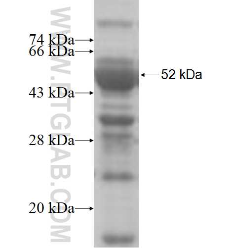 RFX3 fusion protein Ag6413 SDS-PAGE
