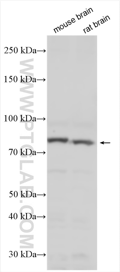 Western Blot (WB) analysis of various lysates using RFX4 Polyclonal antibody (13971-1-AP)