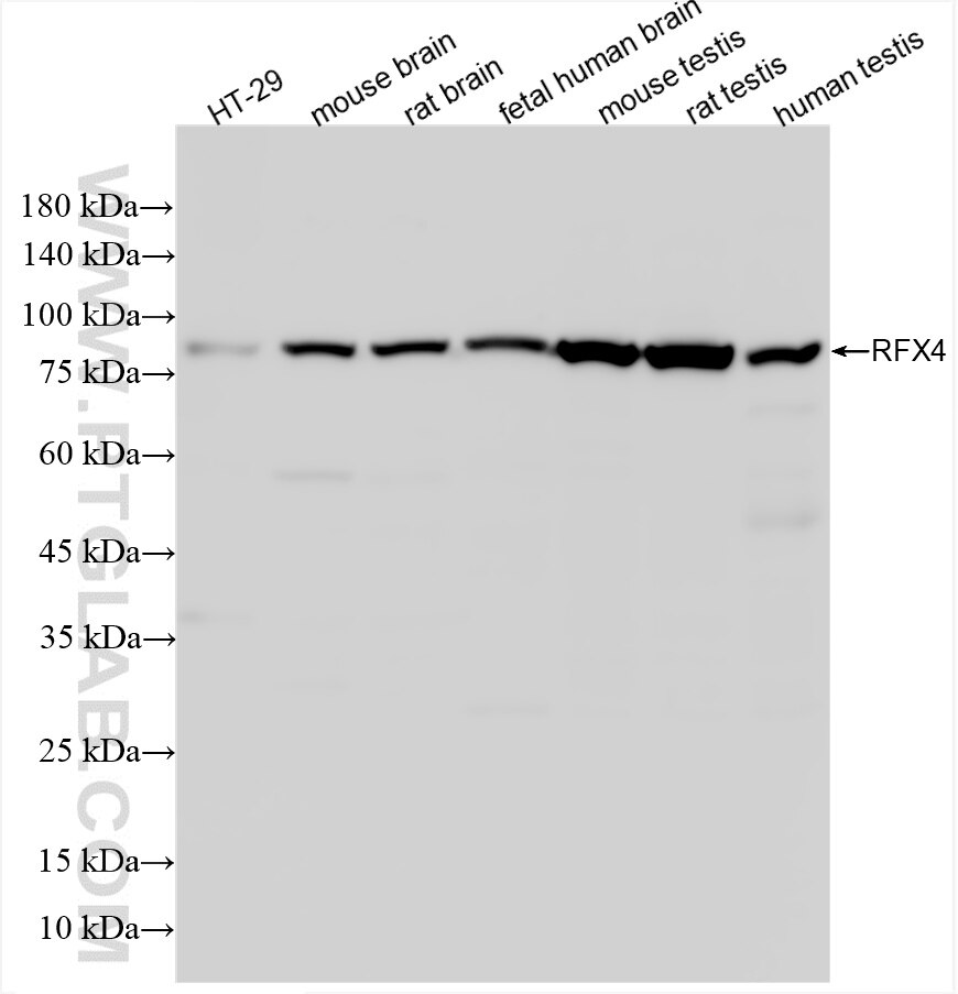 Western Blot (WB) analysis of various lysates using RFX4 Recombinant antibody (86413-1-RR)