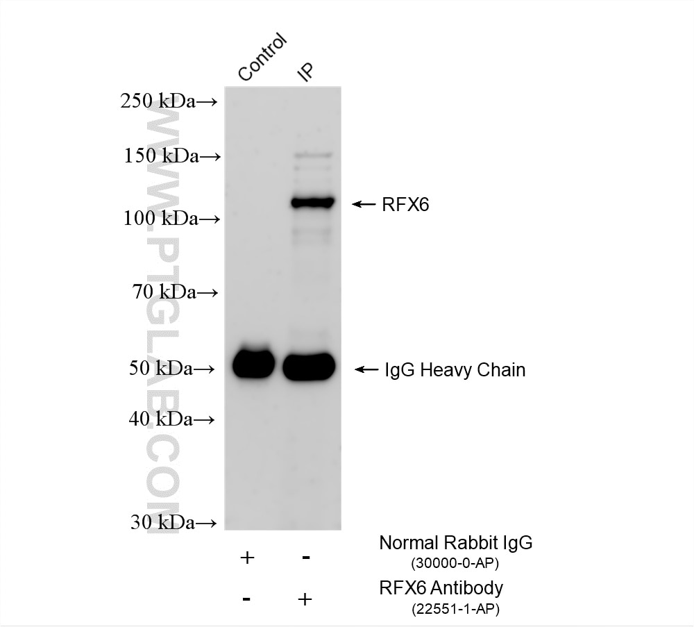 IP experiment of HEK-293 using 22551-1-AP Immunoprecipitation (IP) experiment of HEK-293 cells using RFX6 Polyclonal antibody (22551-1-AP)