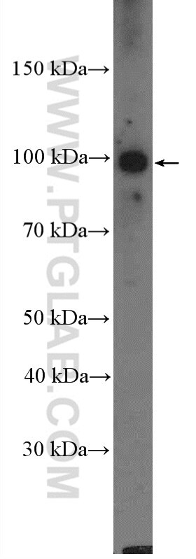 Western Blot (WB) analysis of Caco-2 cells using RFX6 Polyclonal antibody (22551-1-AP)