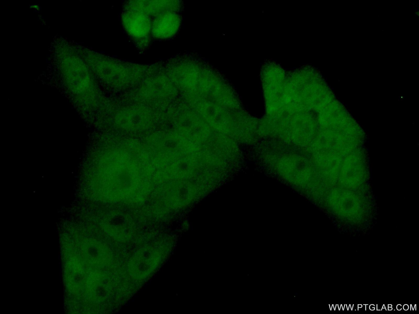 Immunofluorescence (IF) / fluorescent staining of HeLa cells using RFXAP Polyclonal antibody (20188-1-AP)
